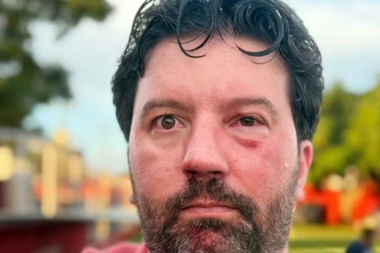 Radialista denuncia agressão de jogador e relata fraturas no rosto após partida em Goiás